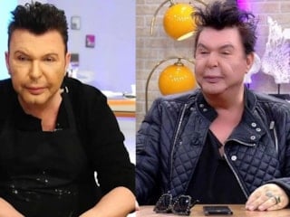 Estetik olmuştu! Kuşum Aydın'ın yüzünün son halini paylaştı