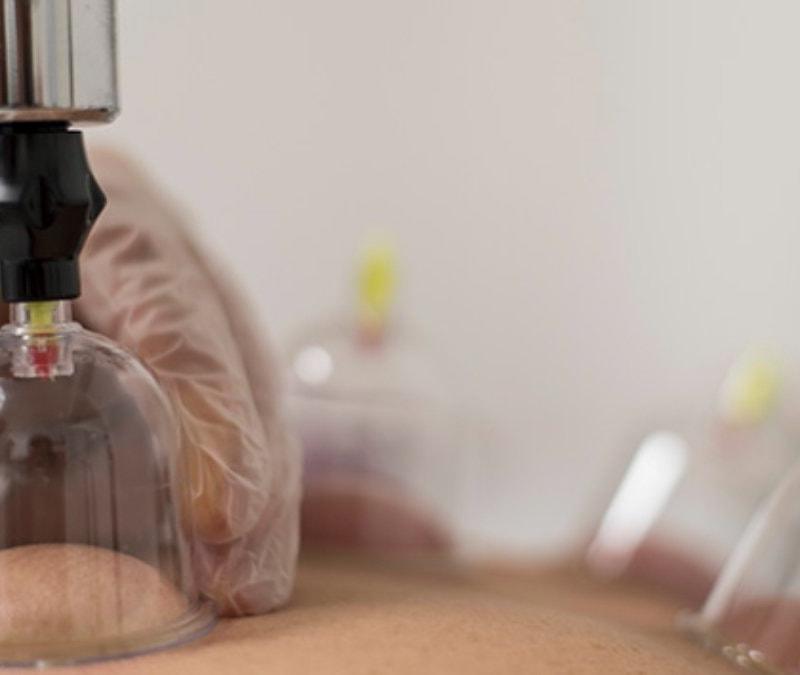 Nisan 2026 hacamat günleri: Sünnet olan hacamat tarihleri