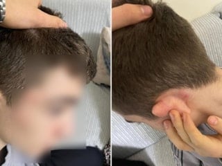 İstanbul'da hırsızlık yaptı sandılar: 14 yaşındaki çocuğu tekme tokat dövdüler