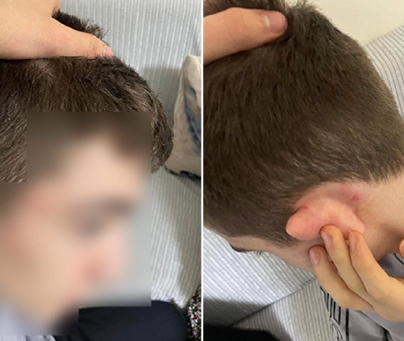 İstanbul'da hırsızlık yaptı sandılar: 14 yaşındaki çocuğu tekme tokat dövdüler