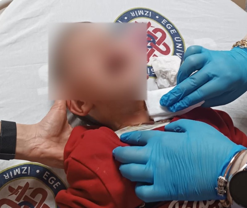 İzmir’de parkta dehşet: 2 yaşındaki çocuğu boğazından bıçakladı