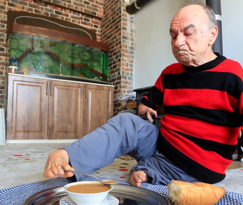 Antalya'da doğuştan elleri olmayan adam her işini ayakaları ile görüyor