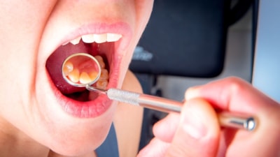 Şişen damaklara dikkat: İşte yaptığınız hata