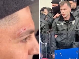 Bursa’da CHP’liler polise saldırdı: Bazı polisler yaralandı