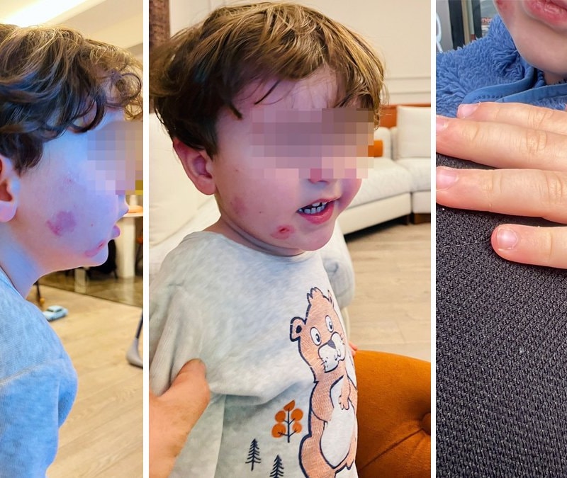 Bursa'da kreşe sağlam giren çocuk, akşam darbedilmiş halde çıktı