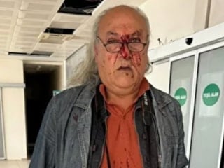 CHP'li Ayvalık Belediyesi'nin korumalarından gazeteci Yüksel Kalkan'a darp