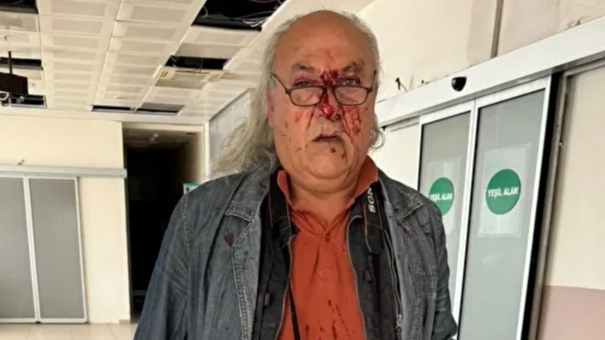 CHP'li Ayvalık Belediyesi'nin korumalarından gazeteci Yüksel Kalkan'a darp