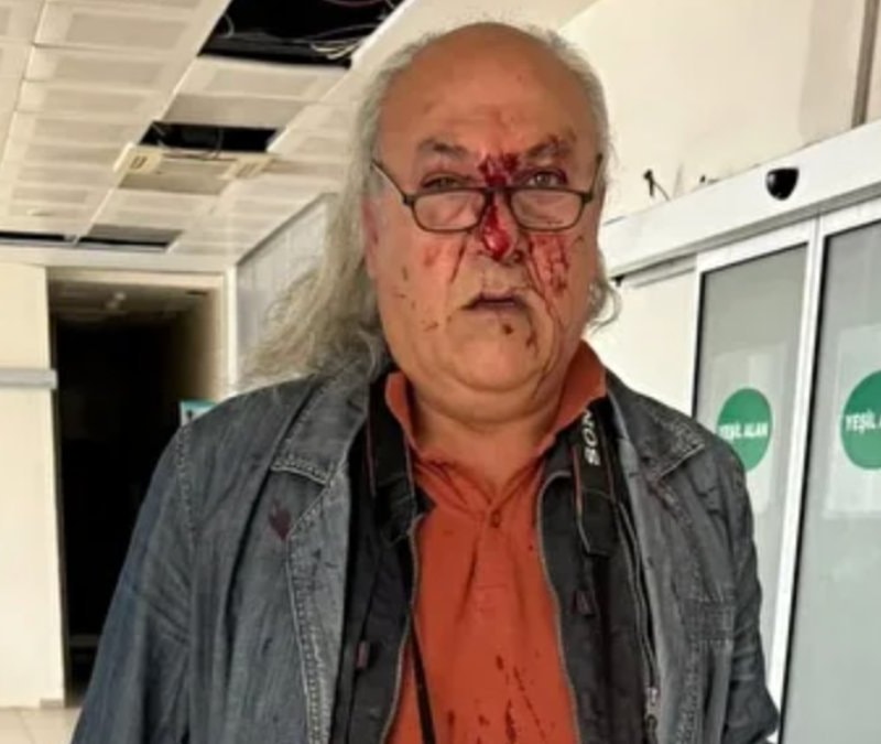 CHP'li Ayvalık Belediyesi'nin korumalarından gazeteci Yüksel Kalkan'a darp