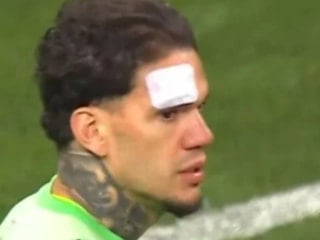 Kayserispor - Fenerbahçe maçında Ederson'a yabancı madde geldi