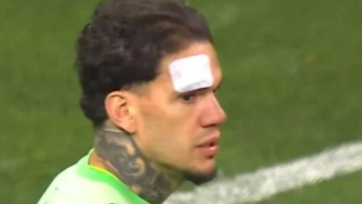 Kayserispor - Fenerbahçe maçında Ederson'a yabancı madde geldi