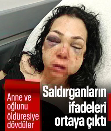 Kocaeli'de anne ve oğlunu öldüresiye darbetmişlerdi: Merdivenlerden düştü