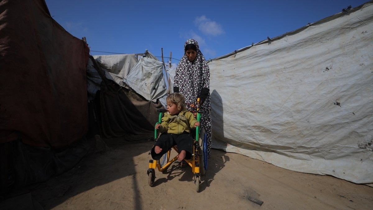 İsrail saldırısında yaralanan 4 yaşındaki Kamer, yeniden yürüyebilmenin hayalini kuruyor