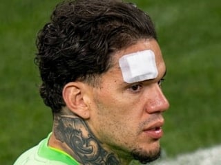 Ederson'a yabancı madde için açıklama