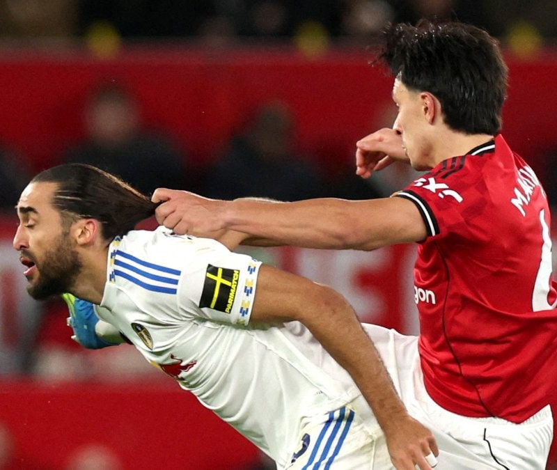 Manchester United'ı 10 kişi bıraktı! Martinez, Calvert-Lewin'in saçını çekti