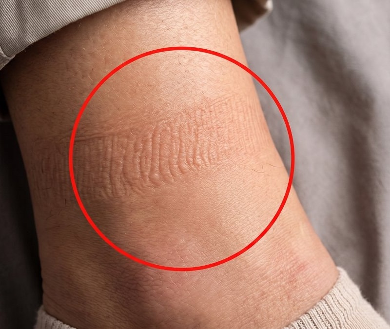 Çorap izlerine dikkat: Asıl sebebi buymuş...