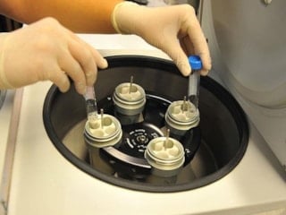 SGK tüp bebek tedavi desteği 2026: Güncel şartları ve yüzdesi