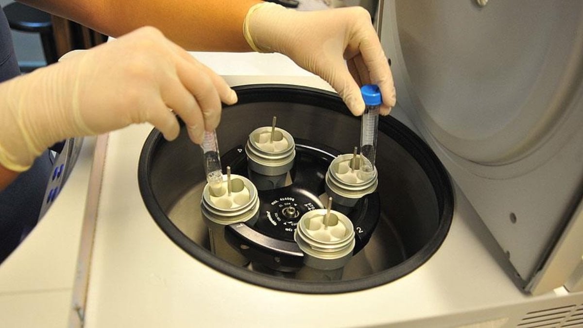 SGK tüp bebek tedavi desteği 2026: Güncel şartları ve yüzdesi