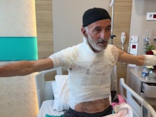 Erzurum'da arızayı tamir ederken üzerine dökülen sıcak su ile yaralandı