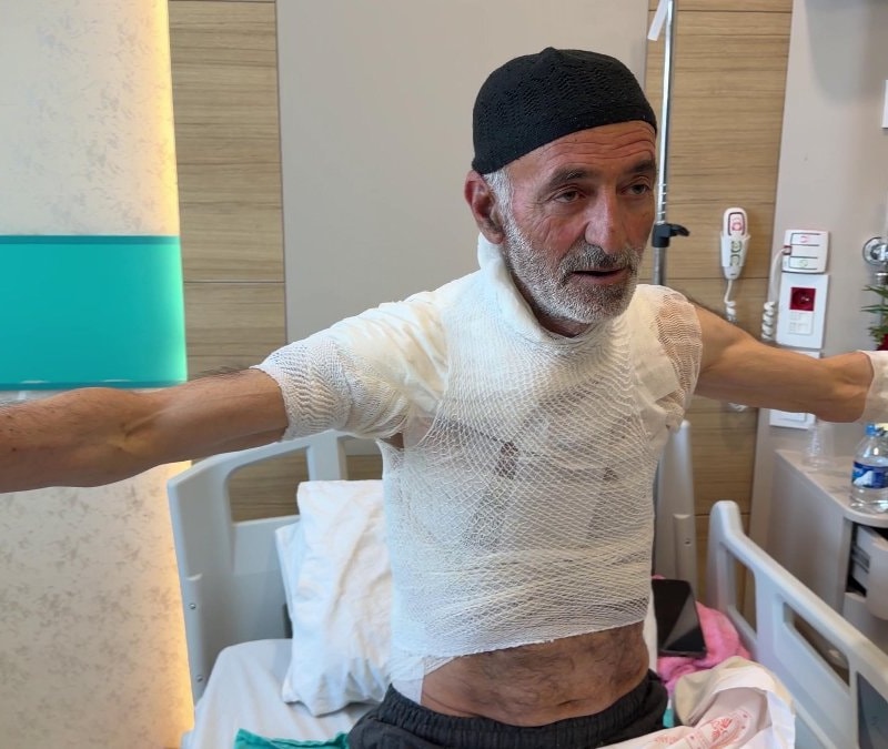 Erzurum'da arızayı tamir ederken üzerine dökülen sıcak su ile yaralandı