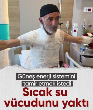 Erzurum'da arızayı tamir ederken üzerine dökülen sıcak su ile yaralandı