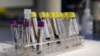 Vedat Işıkhan: Hemofili hastalarına destek olmaya devam