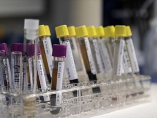 Vedat Işıkhan: Hemofili hastalarına destek olmaya devam