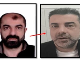 Ankara'da firari 7 sene sonra yakalandı: Ameliyatla yüzünü değiştirdiği ortaya çıktı