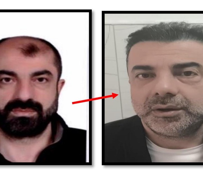Ankara'da firari 7 sene sonra yakalandı: Ameliyatla yüzünü değiştirdiği ortaya çıktı