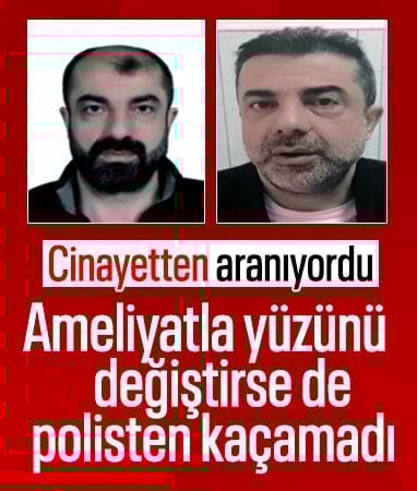 Ankara'da firari 7 sene sonra yakalandı: Ameliyatla yüzünü değiştirdiği ortaya çıktı