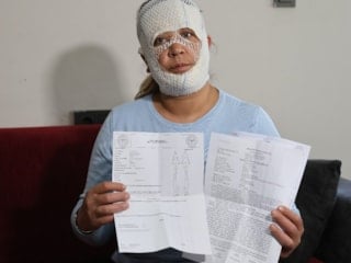 Adana'da güzelleşmek umuduyla işlem yaptırdı: Suratı yandı