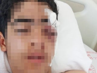 İstanbul'da 15 yaşındaki çocuk muştayla öldüresiye dövüldü