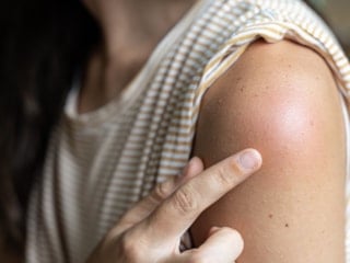 Kollarda başlayan o pütürlü doku ne anlatıyor