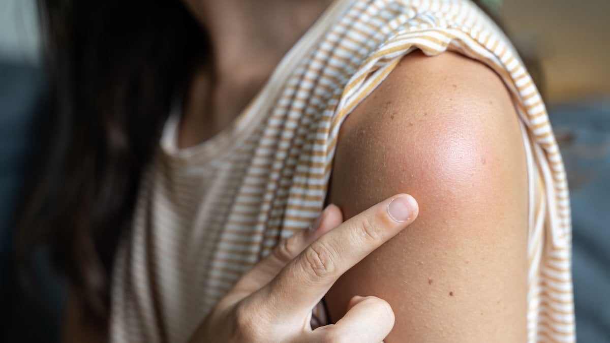 Kollarda başlayan o pütürlü doku ne anlatıyor