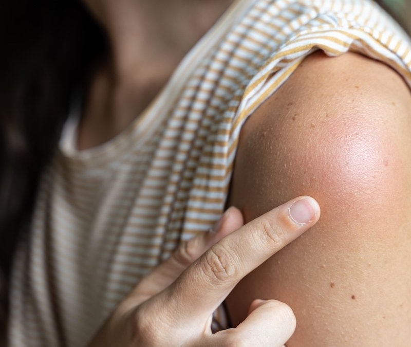 Kollarda başlayan o pütürlü doku ne anlatıyor