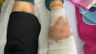 Ankara’da köpek sürüsü saldırısı: Yaşlı kadın ağır yaralandı