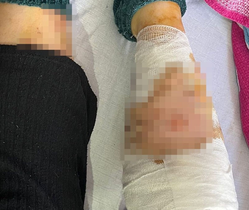 Ankara’da köpek sürüsü saldırısı: Yaşlı kadın ağır yaralandı