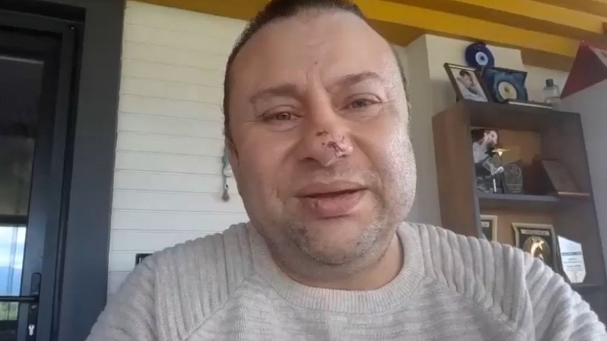 Pitbull saldırısında hastanelik olan Onur Akay o anları anlattı