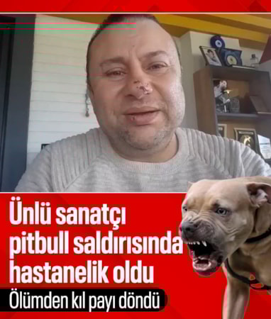 Pitbull saldırısında hastanelik olan Onur Akay o anları anlattı