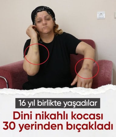 Diyarbakır'da bir kadın dini nikahlı kocası tarafından 30 yerinden bıçaklandı