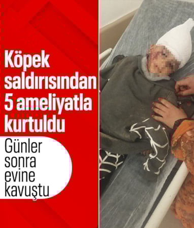 Kayseri'de köpek saldırısında yaralanan 3 yaşındaki bebek, 5 operasyon atlattı