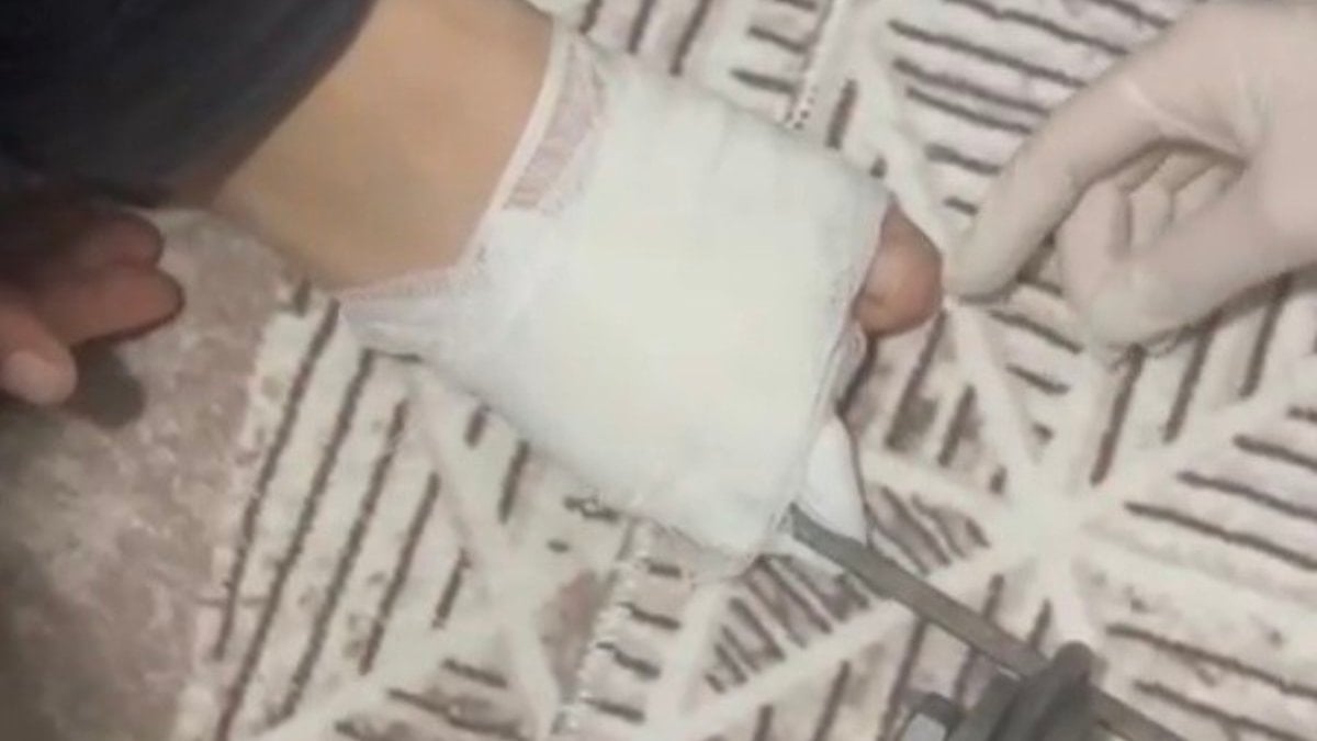 Osmaniye’de korkutan kaza: Ayağına mangal şişi saplanan çocuk hastaneye kaldırıldı