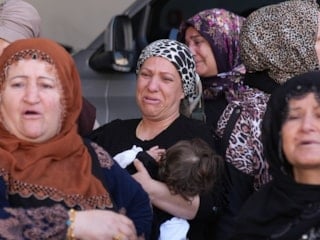 İzmir'de burun ameliyatı sonrası ölüme soruşturma