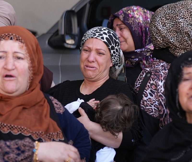İzmir'de burun ameliyatı sonrası ölüme soruşturma