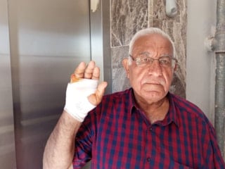 Hatay'da komşusu tarafından parmağı ısırılan adamın parmağı ampute edildi