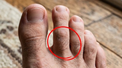 Ayak kıllarınız varsa yaşadınız! Bakın neyin işareti...