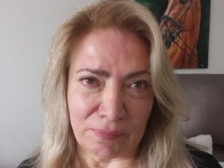 Ankara'da estetik yaptıran kadın yüz felci geçirdi