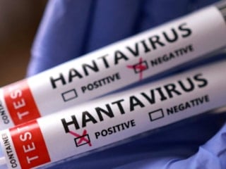 Sağlık Bakanlığı: Türkiye'de 'hantavirüs' vakası yok