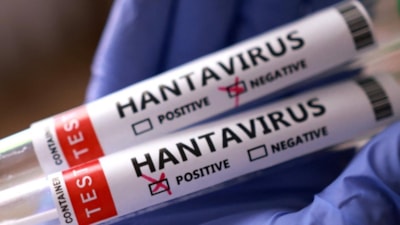 Hantavirüs alarmı sonrası ABD harekete geçti