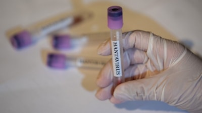 Dünya Sağlık Örgütü'nden 'hantavirüs' açıklaması: Küresel risk düşük