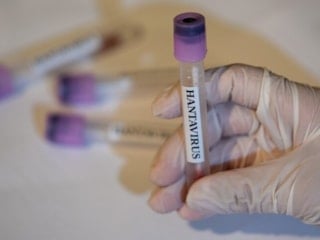 Dünya Sağlık Örgütü'nden 'hantavirüs' açıklaması: Küresel risk düşük